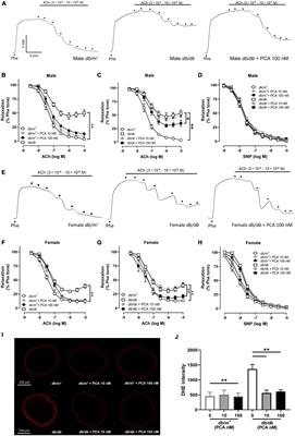 Physiological concentration of protocatechuic acid directly protects vascular endothelial function against inflammation in diabetes through Akt/eNOS pathway